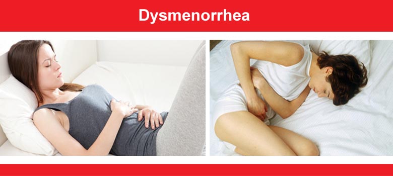 Dysmenorrhea (Painful Menses)