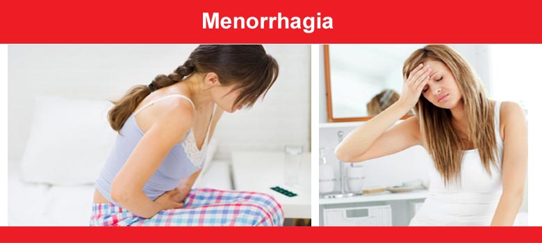 Menorrhagia (Heavy Periods)