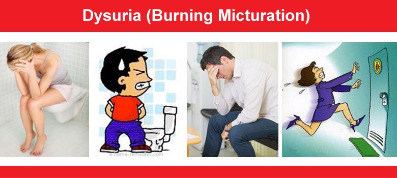 Dysuria (Burning Micturition)
