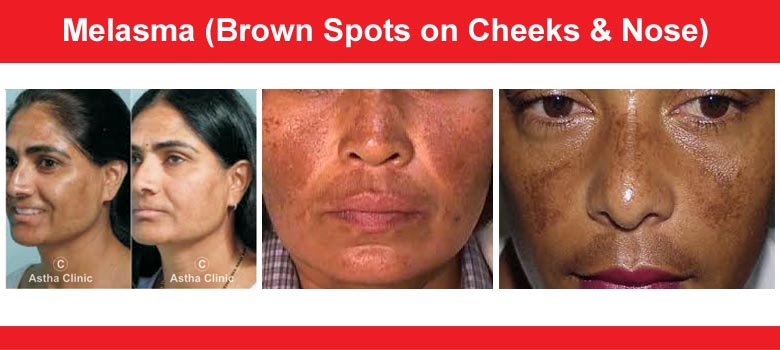 Skin Care