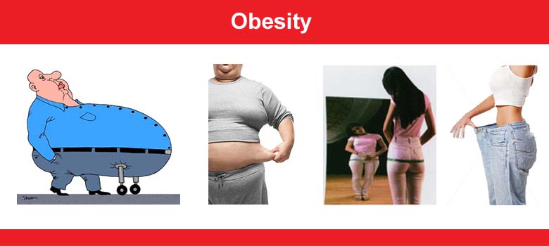 Obesity