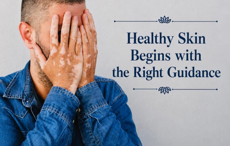 Natural Vitiligo treatment and holistic skin care support for white patches