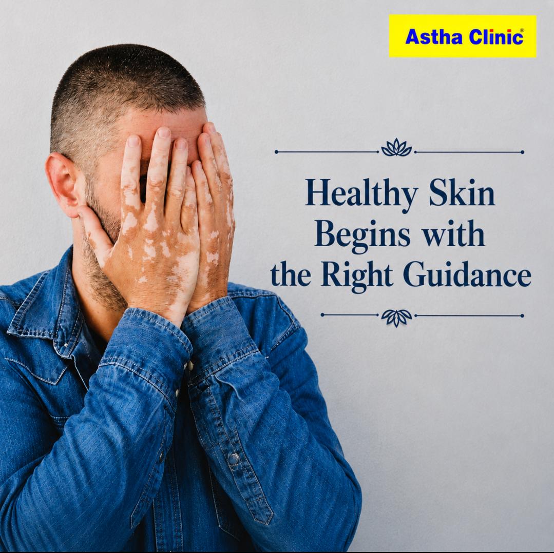 Natural Vitiligo treatment and holistic skin care support for white patches